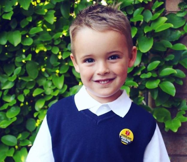 Jack Patterson wearing a badge which lets others know he has severe food allergies