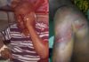 Nana Kwasi Agyemang IX was brutalised by men allegedly hired by Nana Hema Dekye
