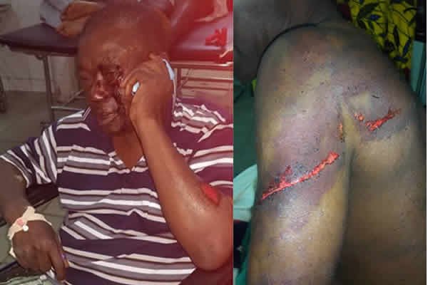 Nana Kwasi Agyemang IX was brutalised by men allegedly hired by Nana Hema Dekye