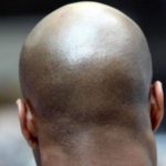 Calling a man ‘bald’ is considered sexual harassment, tribunal rules bald men