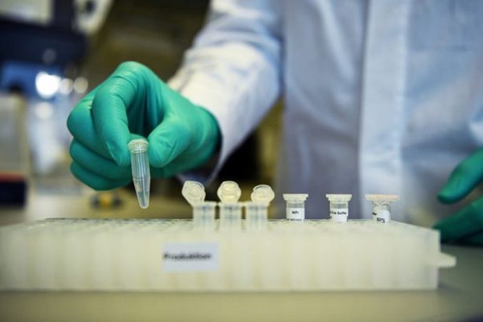 1_FILE-PHOTO-Employee-Philipp-Hoffmann-of-German-biopharmaceutical-company-CureVac-demonstrates-res (Copy) coronavirus