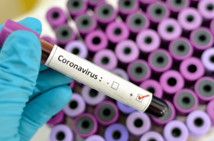 Coronavirus