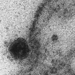 coronavirus cells