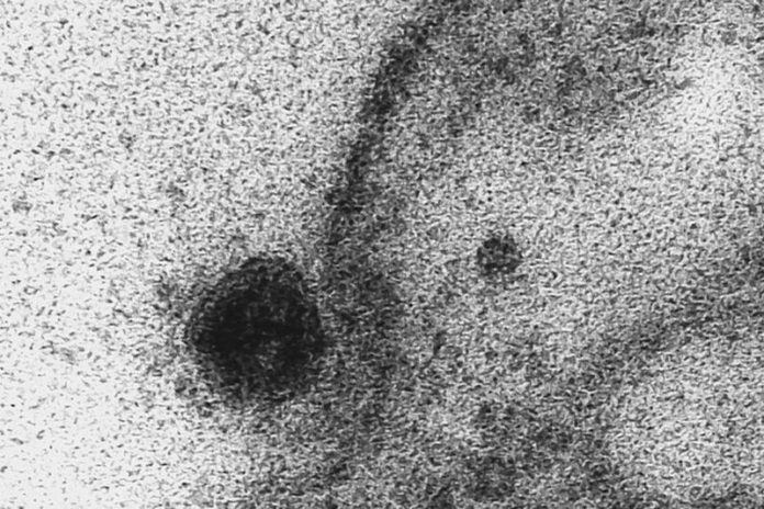 coronavirus cells