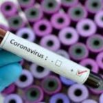 Read: Filling Station closed down at Dome-Kwabenya after staff tests positive for Coronavirus