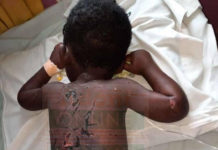 Father beats 3-year-old son with naked wire child abuse