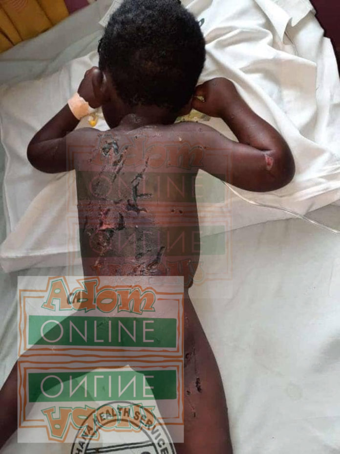 Father beats 3-year-old son with naked wire child abuse Father beats 3-year-old son with naked wire child abuse