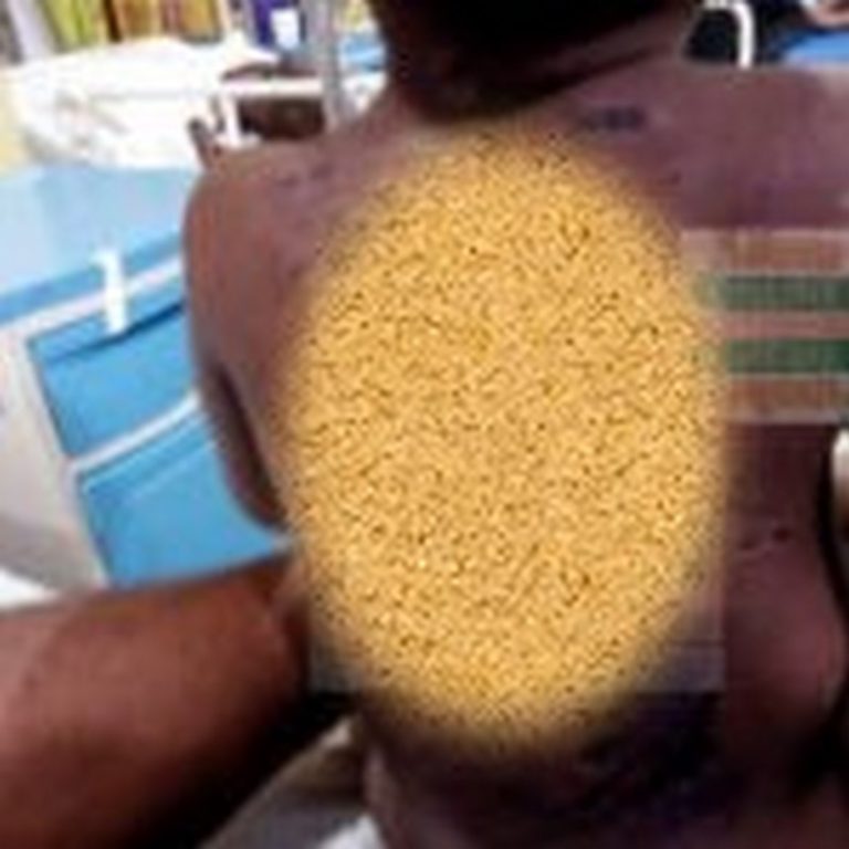 Mother breaks silence on torture 3-year-old suffered at hands of father [Listen]