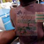 Father beats 3-year-old son with naked wire child abuse