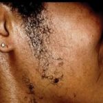 File photo: Woman with facial hair