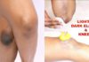 Lemon, baking soda, coconut oil can be used to lighten your dark elbows and knuckles
