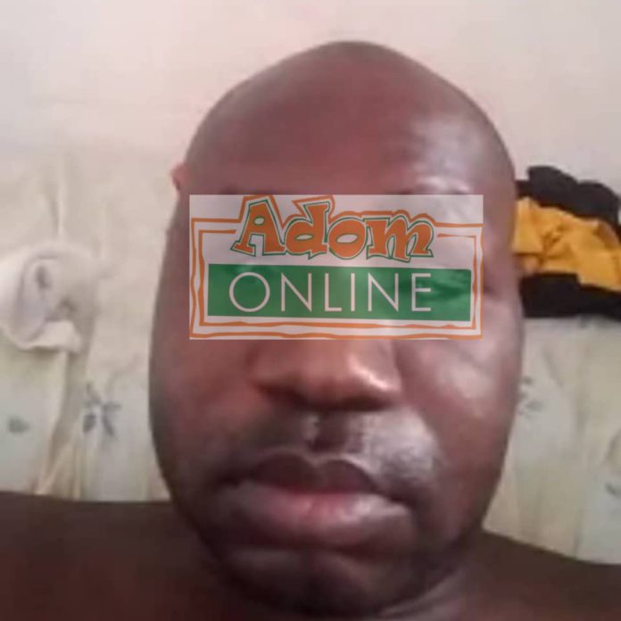 Blind Man Cephas Pagayiri, a community health nurse in Navrongo has narrated how he lost his eyes from what seems to have been a stray bullet. Cephas Pagayiri, a community health nurse in Navrongo has narrated how he lost his eyes from what seems to have been a stray bullet.