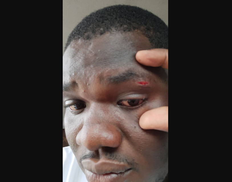 Bright SHS students assault school officials