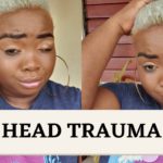 This woman woke up from coma with British accent