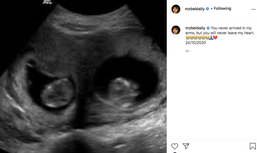 Singer Mzbel has shared an ultrasound picture of her pregnancy after she suffered miscarriage on Saturday, October 24, 2020. 
