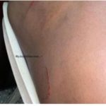 Keta MP-Elect attacked