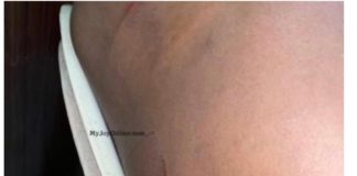 Keta MP-Elect attacked