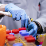 If you have this blood type, you’re at a high risk of severe Covid