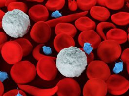 18,000 children born with sickle cell disease annually in Ghana – WHO