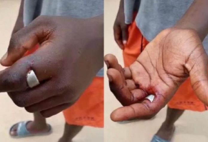 The young man wearing the 'sakawa' ring lives at Iron City in Kasoa The young man wearing the 'sakawa' ring lives at Iron City in Kasoa