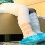 Lady whose boyfriend burnt son to death reeling under huge medical bills