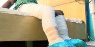 Lady whose boyfriend burnt son to death reeling under huge medical bills