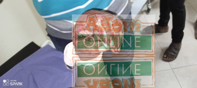 Man allegedly hires thugs to inflict cutlass wounds on mother, son at Kasoa [Photos]