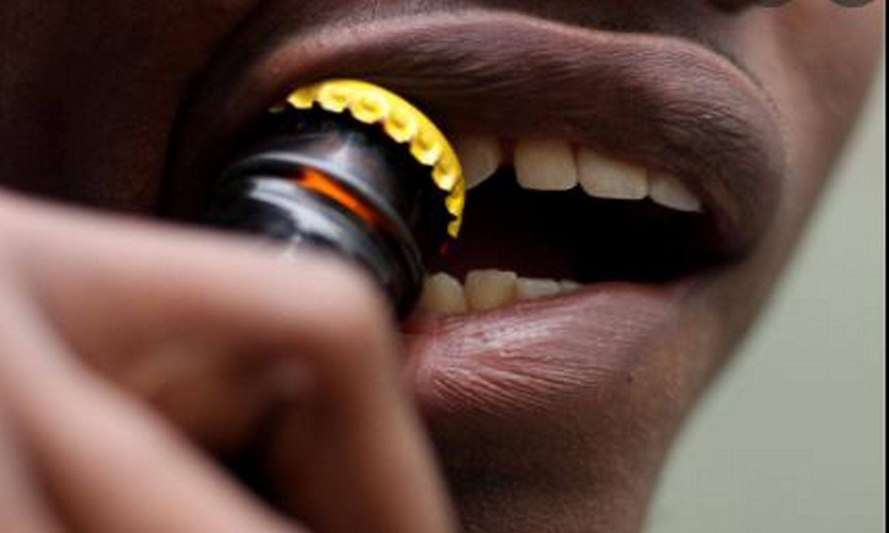Don't open bottle lids with teeth Dentist advises