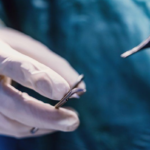 1st patient to undergo Brain Mapping Surgery in Ghana speaks of his successful surgery