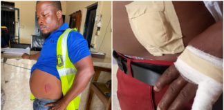 Mamprobi: ‘SWAT officer’ to face PIPS for ‘senselessly’ beating assemblyman