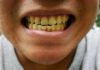 5 effective ways to get rid of yellow teeth
