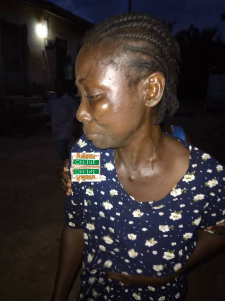 Man allegedly assaults wife over fish