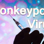 Monkeypox