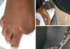 Unverified screenshots spreading around on WhatsApp, Twitter, and Facebook suggest that some sell their toes for as much as US$40,000 for the big toe, US$25,000 for the middle toe and US$10,000 for the tiny toe.