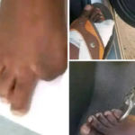 Unverified screenshots spreading around on WhatsApp, Twitter, and Facebook suggest that some sell their toes for as much as US$40,000 for the big toe, US$25,000 for the middle toe and US$10,000 for the tiny toe.