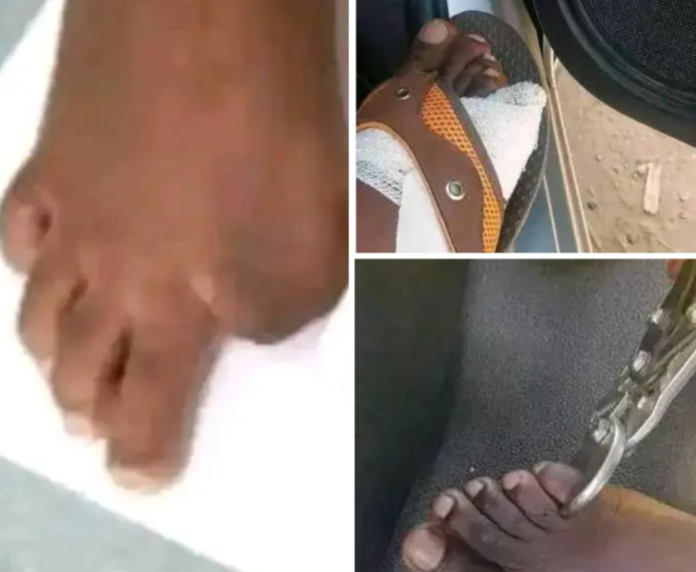 Unverified screenshots spreading around on WhatsApp, Twitter, and Facebook suggest that some sell their toes for as much as US$40,000 for the big toe, US$25,000 for the middle toe and US$10,000 for the tiny toe.