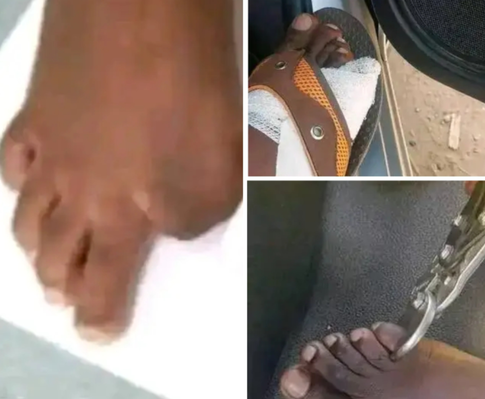 Police probe sale of human toes for riches in Zimbabwe