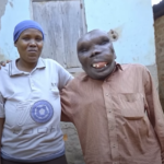 Why I married the ‘ugliest man in the world’ – Wife shares interesting story