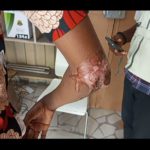 Carpenter allegedly pours acid on 14-year-old boy for attempting to ease himself in his shop