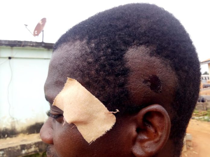 2 injured in chieftaincy clash at Assin Adiembra