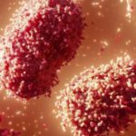 Monkeypox is similar to smallpox but less severe and less infectious too - Image Source: SCIENCE PHOTO LIBRARY