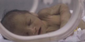 Adnan's condition has improved significantly since he was admitted to hospital with dehydration and jaundice
