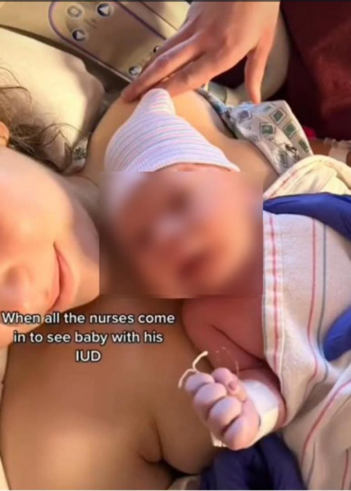 Woman who got pregnant while on birth control gives birth to baby holding IUD