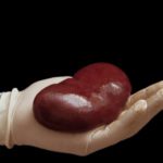 Kidney-Transplant-Care source: https://accordhospitals.co.in/