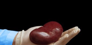 Kidney-Transplant-Care source: https://accordhospitals.co.in/