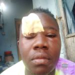 Woman bites off trader’s forehead over GH₵20 debt