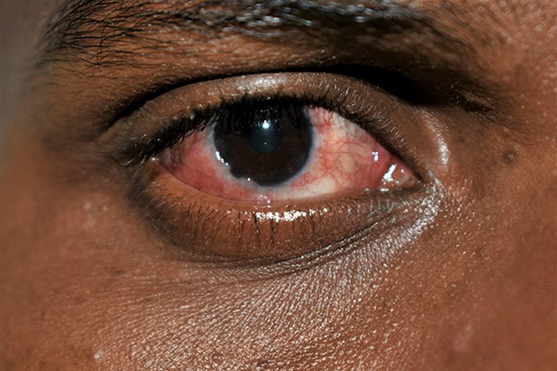 GHS warns of rapid spread of Apollo across all 16 regions - Adomonline.com