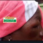 Woman’s eye swollen after alleged assault by ECG taskforce