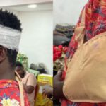 TESCON member sustains head injury