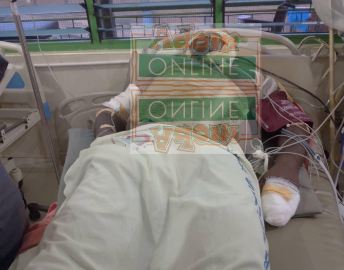 Assin Fosu: Robbers attack cocoa officer and loots Gh¢100,000 cash